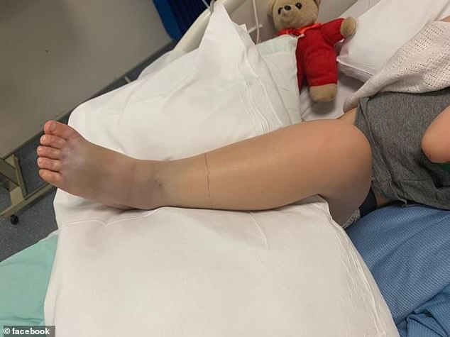 Băiețel de trei ani, paralizat după ce a fost mușcat de un șarpe 