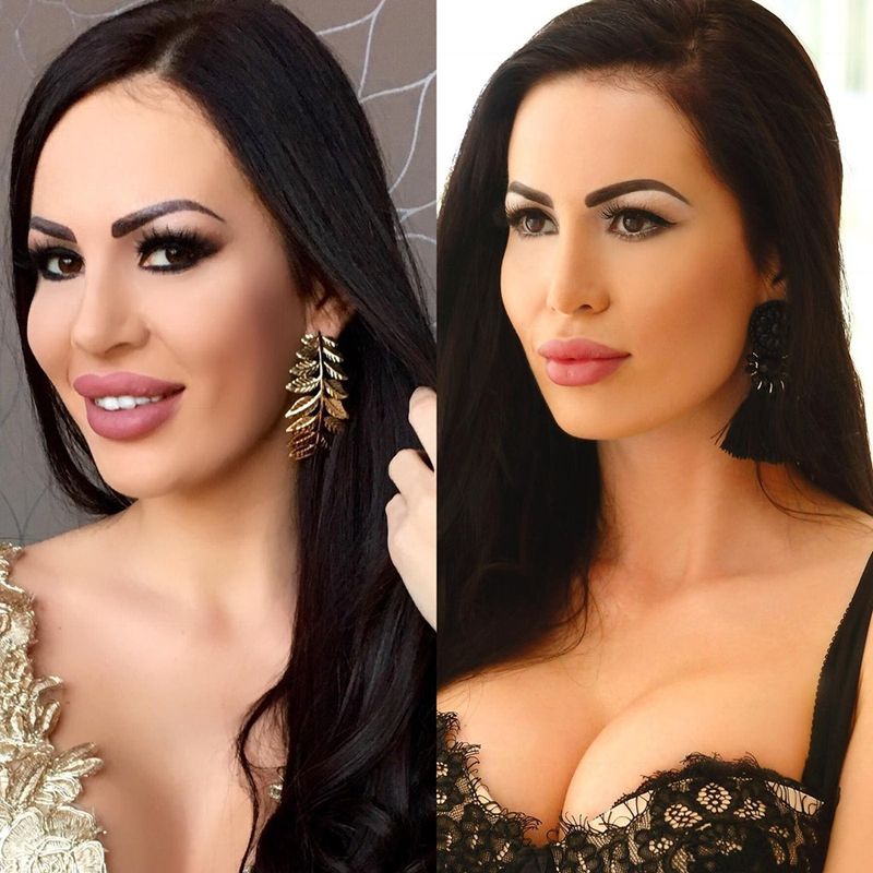 Bianca Pop, pe masa de operație! Ce se &icirc;nt&acirc;mplă cu celebra ispită?