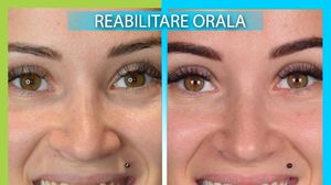 După o copilărie traumatizată, Ana Maria Barnoshi zâmbește din nou 