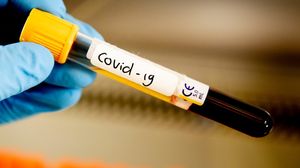 Bilanț coronavirus 29 iulie 2020: 1.182 de noi cazuri de coronavirus 
