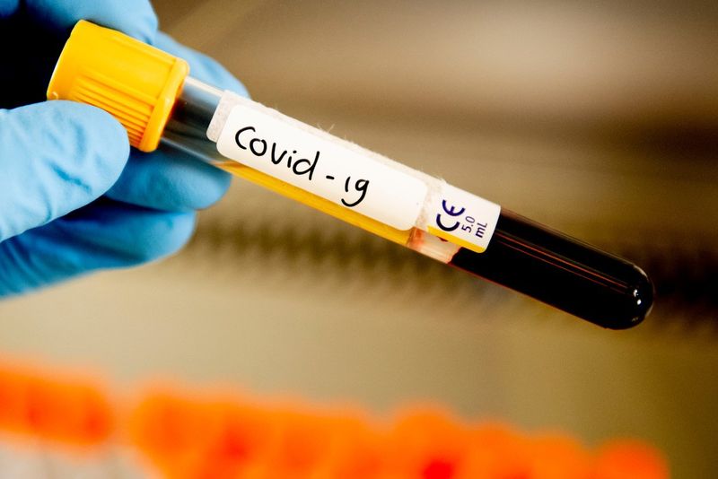 Bilanț coronavirus 29 iulie 2020: 1.182 de noi cazuri de coronavirus 