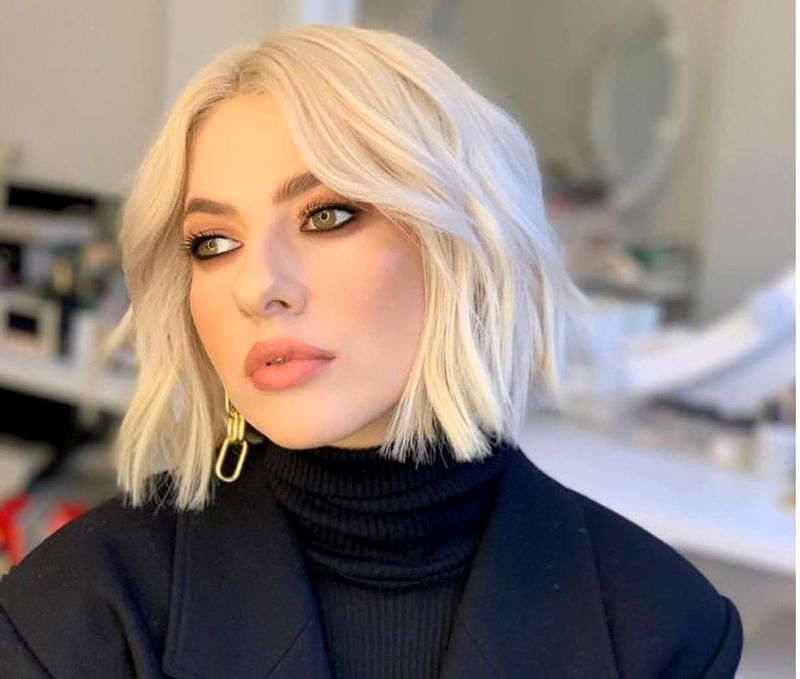 Lidia Buble, cu corpul plin de vânătăi! Imagini șocante. Ce s-a întâmplat cu artista?