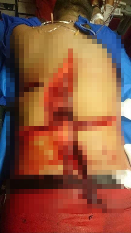 Cine este Ciprian Napy, ucigașul interlopului Emi Pian. Este internat &icirc;n spital cu spatele despicat FOTO