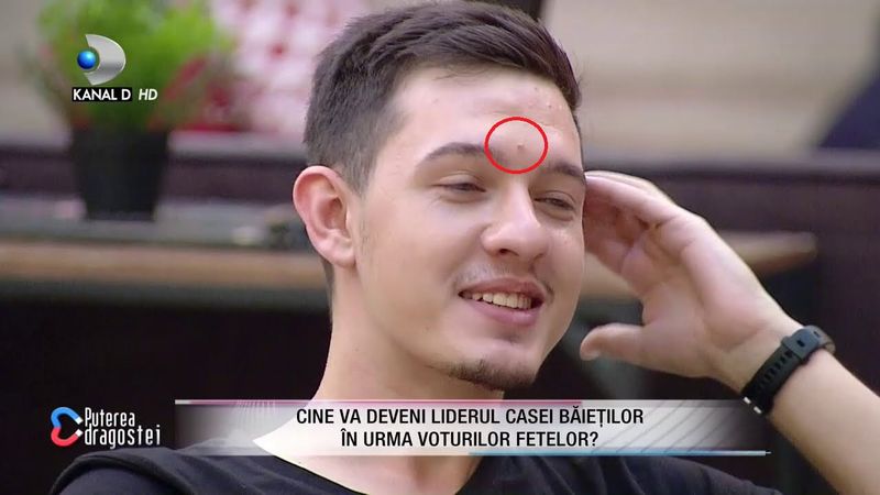 Cristi Comanici semn frunte