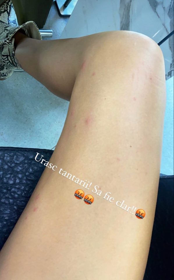 Adelina Pestritu muscata de tantari