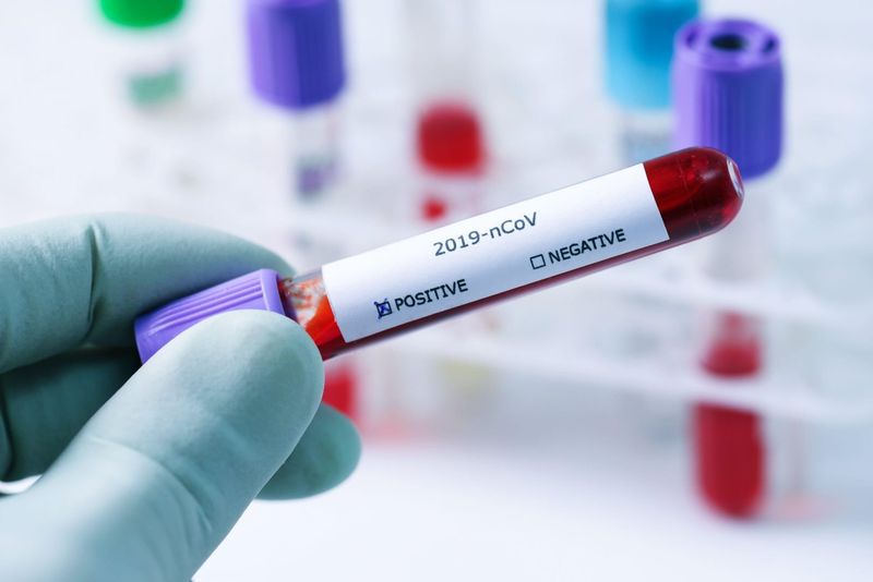 test coronavirus