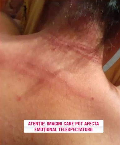Soți din iași Bătuți