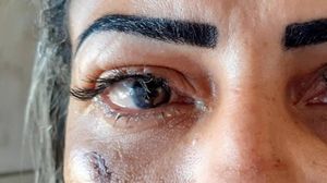 Femeia care a suferit un accident în timp ce își punea gene false