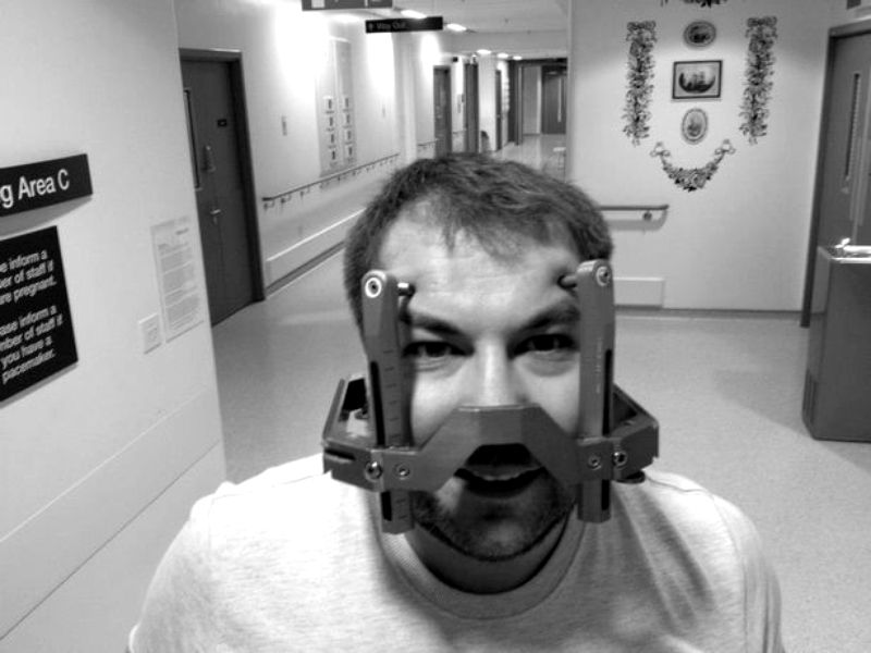 Drama unui bărbat diagnosticat cu tumoare pe creier 