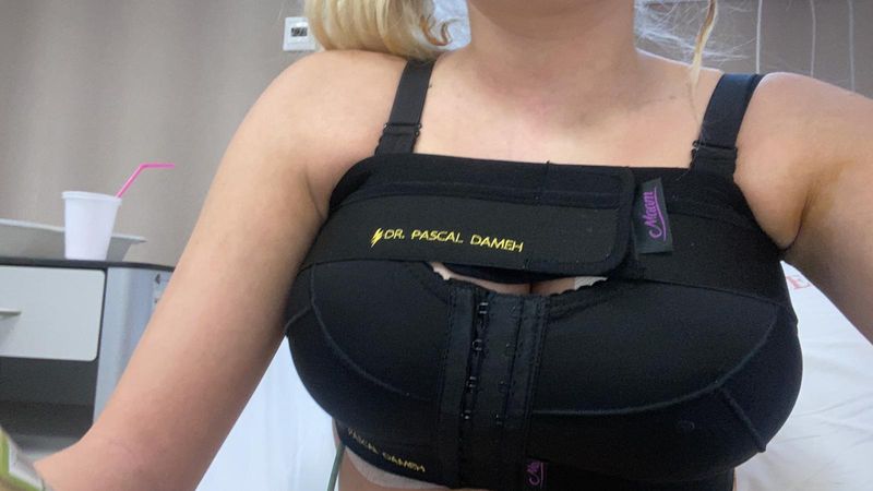 Bernadett si-a facut un implant mamar Bernadett