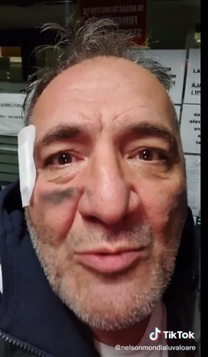 Nelson Mondialu în spital