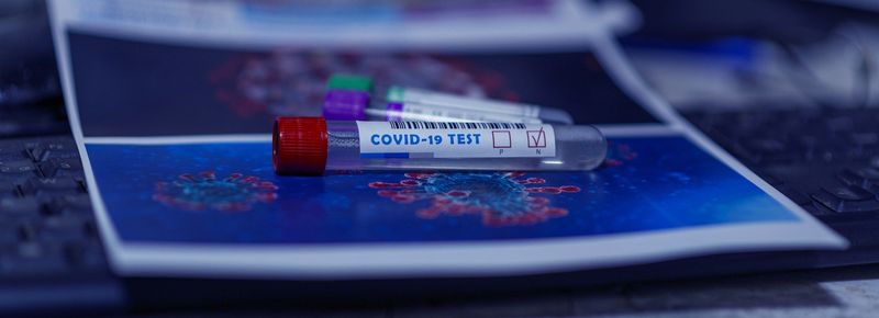 Teste rapide pentru COVID-19. Cât va costa unul?