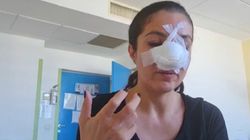 Detalii de la audieri. Ce a mărturisit Cristina Joia după ce a fost desfigurată în bătaie