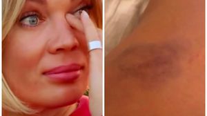 Gina Pistol s-a rănit grav, în urma unei căzături