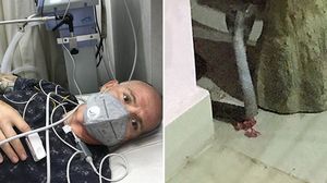 Bărbatul mușcat de o cobră