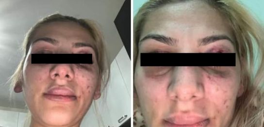 Tzancă Uraganu, declarații despre soția sa bătută