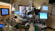 ecmo