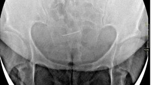 O femeie a mers la doctor, după ce a început să se simtă din ce în ce mai rău