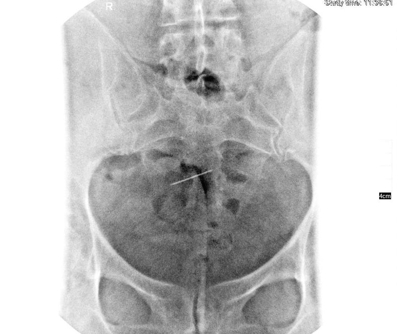 O femeie a mers la doctor, după ce a început să se simtă din ce în ce mai rău