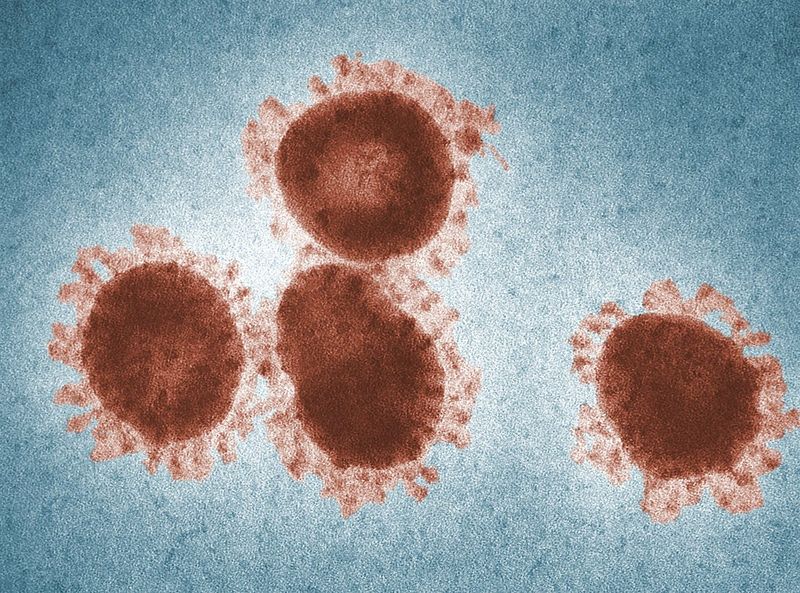 virus 