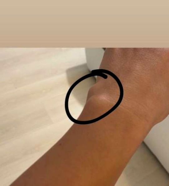 Problemele se țin lanț de Ana Maria Mocanu! Asistenta de televiziune se confruntă cu o nouă problemă de sănătate 