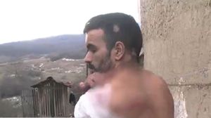 Un bărbat din Sibiu susține că a fost bătut cu bestialitate de către un polițist!  Un bărbat din Sibiu susține că a fost bătut cu bestialitate de către un polițist!