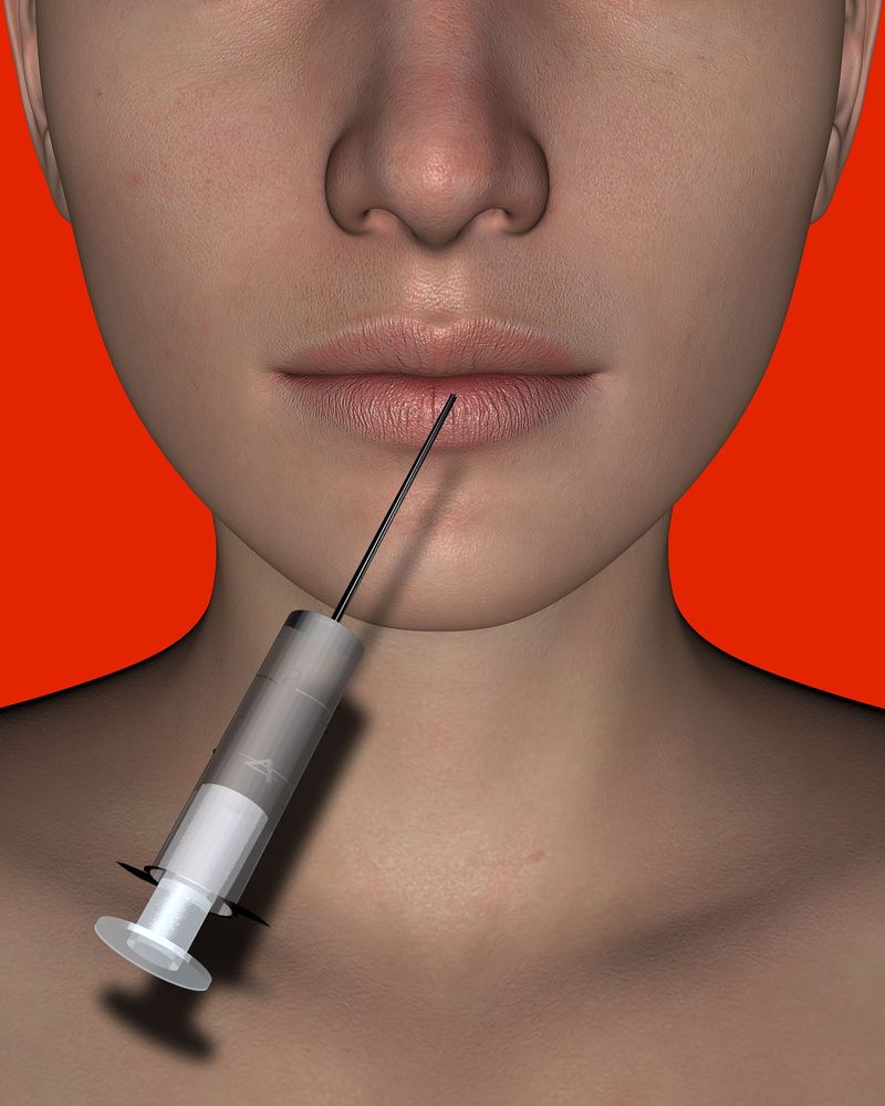 Femeile cu acid hialuronic, reacții adverse la vaccinul anti-COVID-19?! 