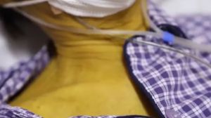 Un bătrân a devenit galben, la propriu!