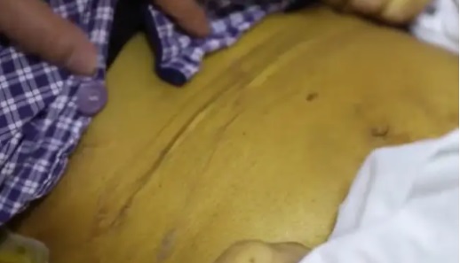 Un bătr&acirc;n a devenit galben, la propriu!