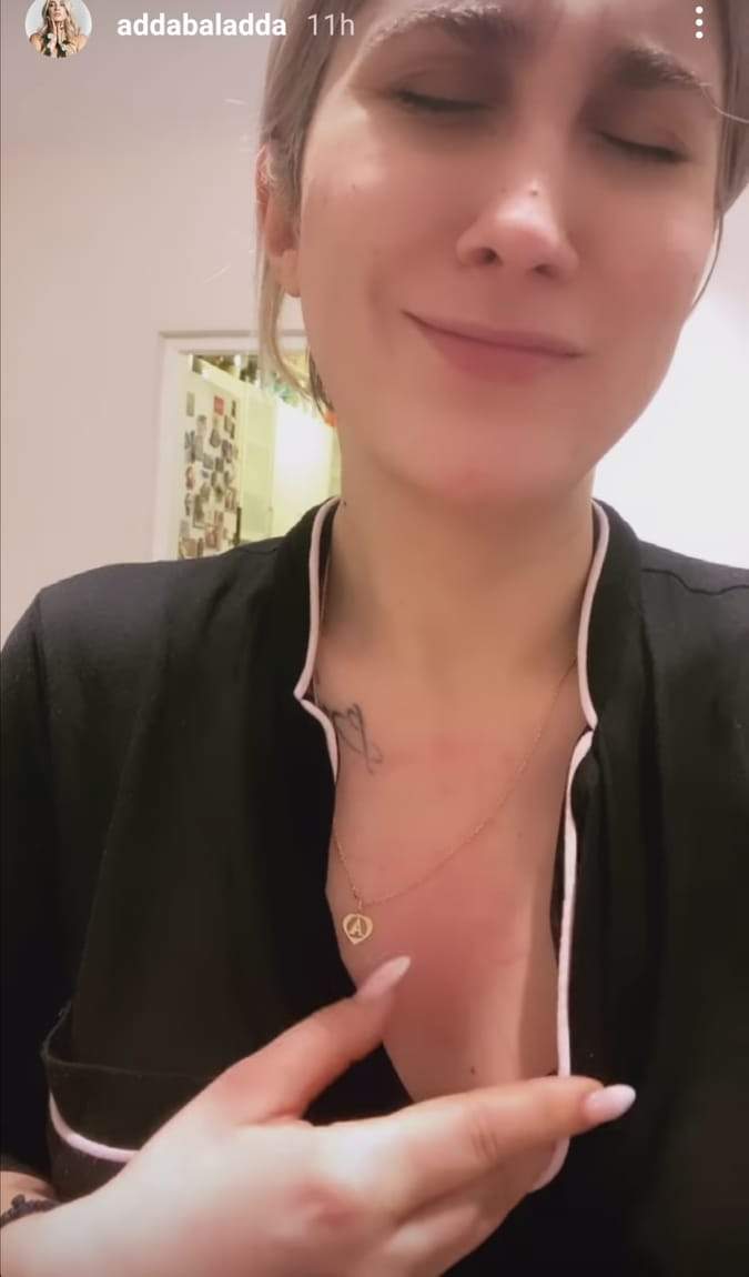 Adda se confruntă cu probleme serioase de sănătate! C&acirc;ntăreața a apărut cu trupul rănit