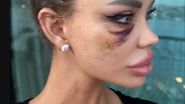 Bianca Drăgușanu, snopită în bătaie 