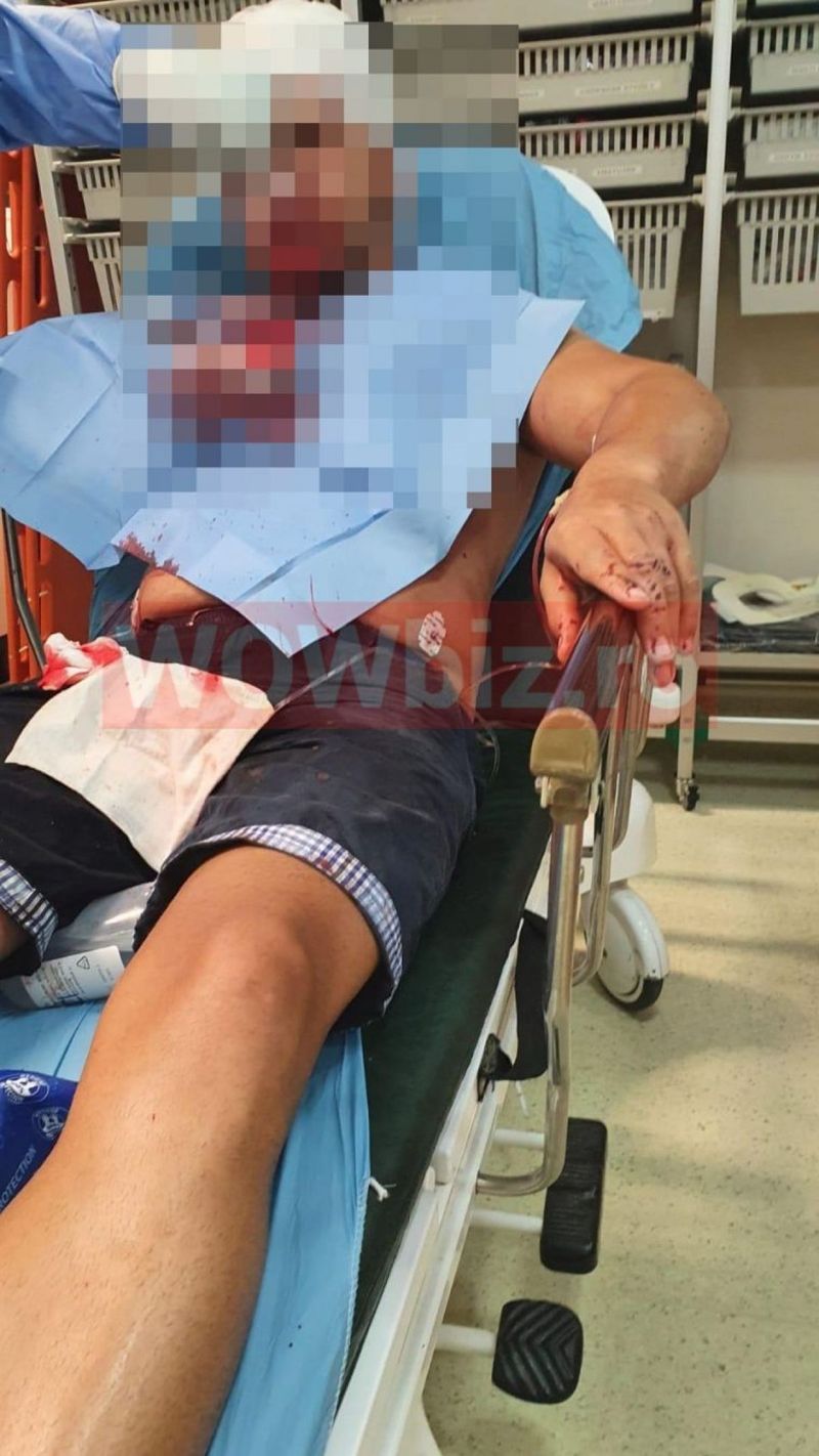 fratele alinei pana batut