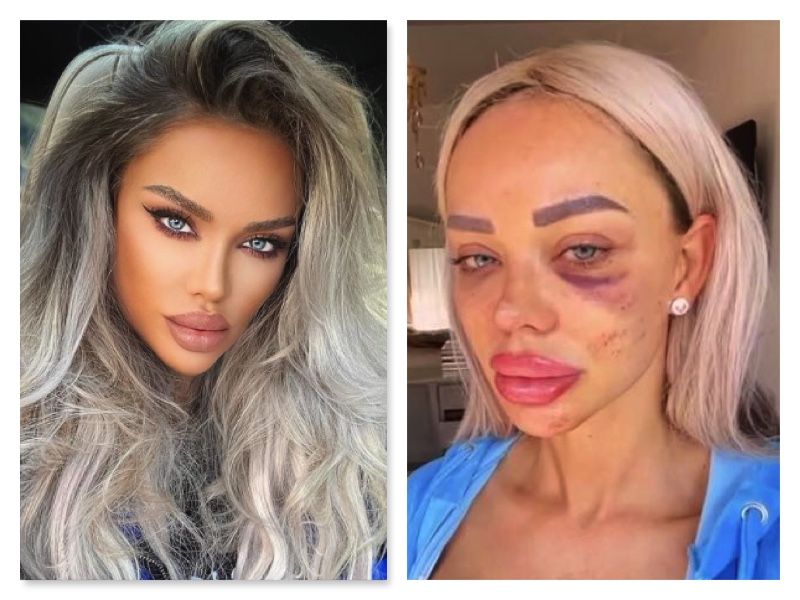 Bianca Drăgușanu, bătută