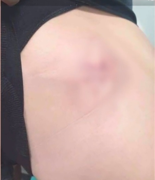 Minoră de 14 ani, bătută cu bestialitate de către propriul tată! Imagini șocante 