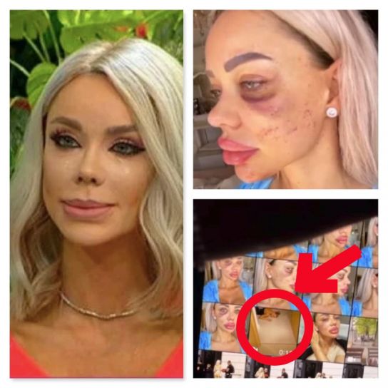 Bianca Drăgușanu, dezvăluiri cutremurătoare despre bătăile încasate! A reușit să fugă cu menajera din mâinile fostului soț: &quot;Mă ținea cu forța în casă...&quot;