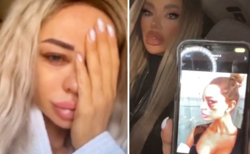 Bianca Drăgușanu bătută