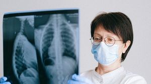 Caz neașteptat! O femeie s-a stins din viață după un transplant de plămâni infectați cu COVID-19