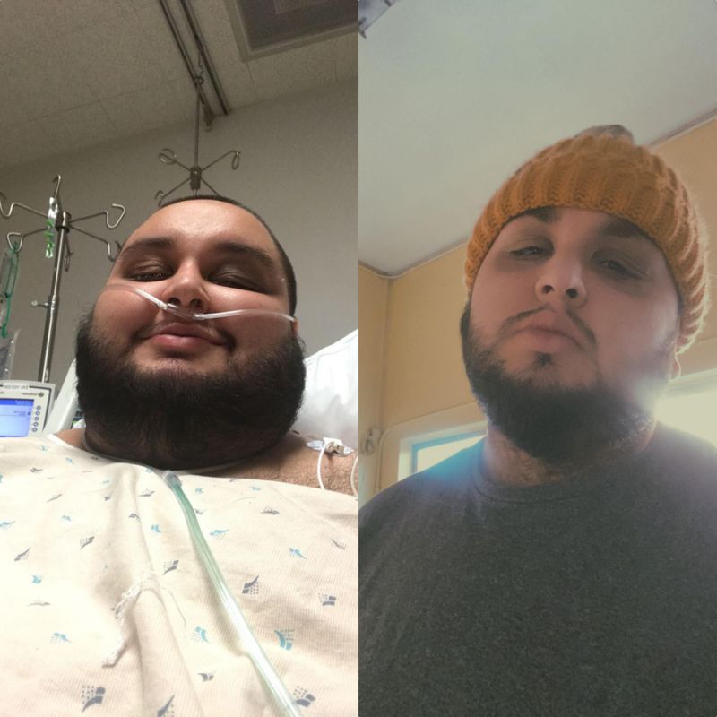 Un t&acirc;năr a pierdut zeci de kilograme &icirc;n c&acirc;țiva ani