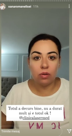 Oana Roman le-a spus fanilor că operația a decurs bine