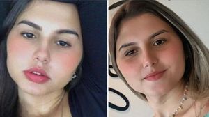 Primele gemene din lume care și-au făcut simulant operațiile de schimbare de sex