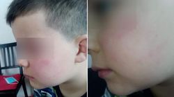 Ireal! Un băiețel de 7 ani a fost bătut cu bestialitate de tatăl unei colege! Învățătoare a luat parte  la scandal