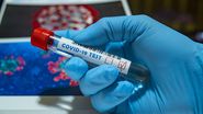 Coronavirus România