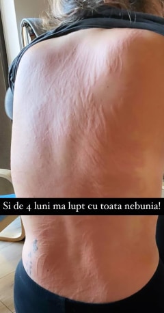 Adda are spatele plin de răni