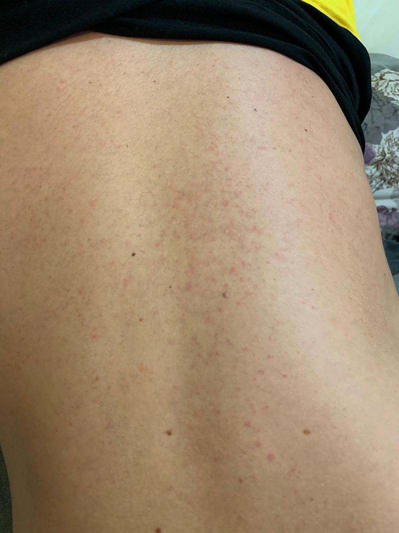 Cum se simte Răzvan Botezatu după vaccinul COVID-19