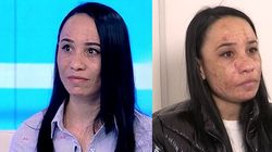 O tânără susține că un cosmetician i-a distrus fața! Incredibil cum a ajuns să arate: "M-a nenorocit..."