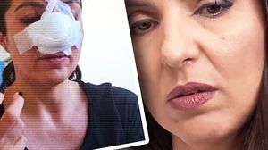 Cum arată Cristina Joia după operațiile suferite la nas, în urma loviturilor încasate de la agresoarea ei: ”Știu că sunt puțin...”