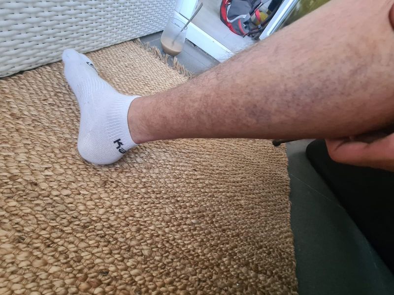 Vânătile de pe picioarele fostului Războinic