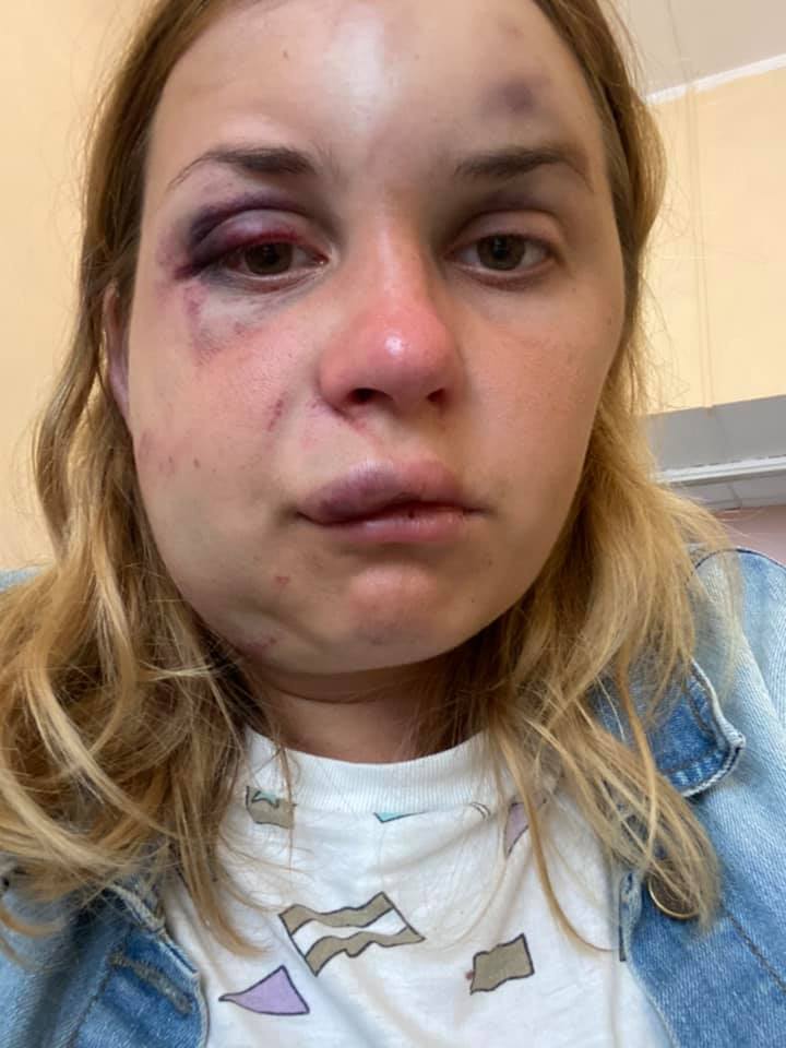 O cunoscută prezentatoare de televiziune a fost bătută și violată într-un tren. Momentele de coșmar prin care a trecut
