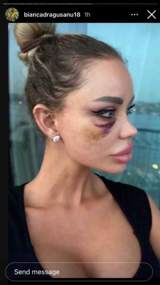 Bianca Drăgușanu  Bianca Drăgușanu