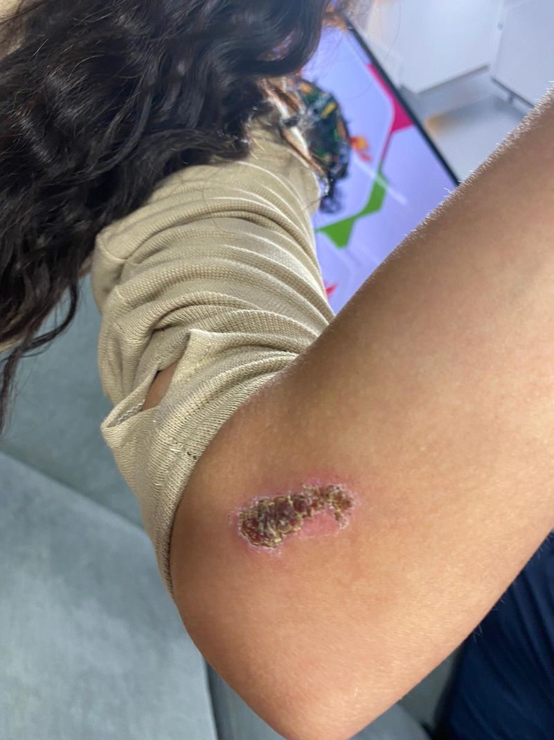 Irisha, răni după Survivor